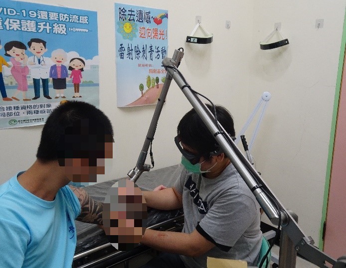 Physician Tattoo Removal